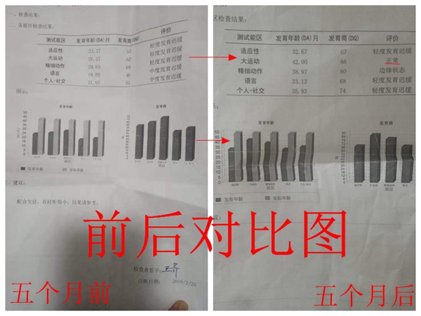 轩轩(化名)的康复训练之路----慢天使的完美蜕变