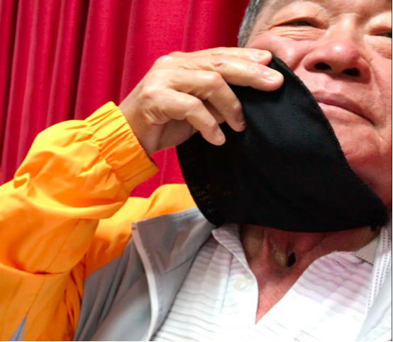 台湾长庚医院治68岁咽喉癌