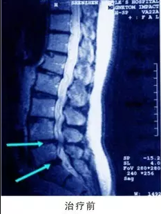 20180310203033_20862.png QQ图片20170214180244.png