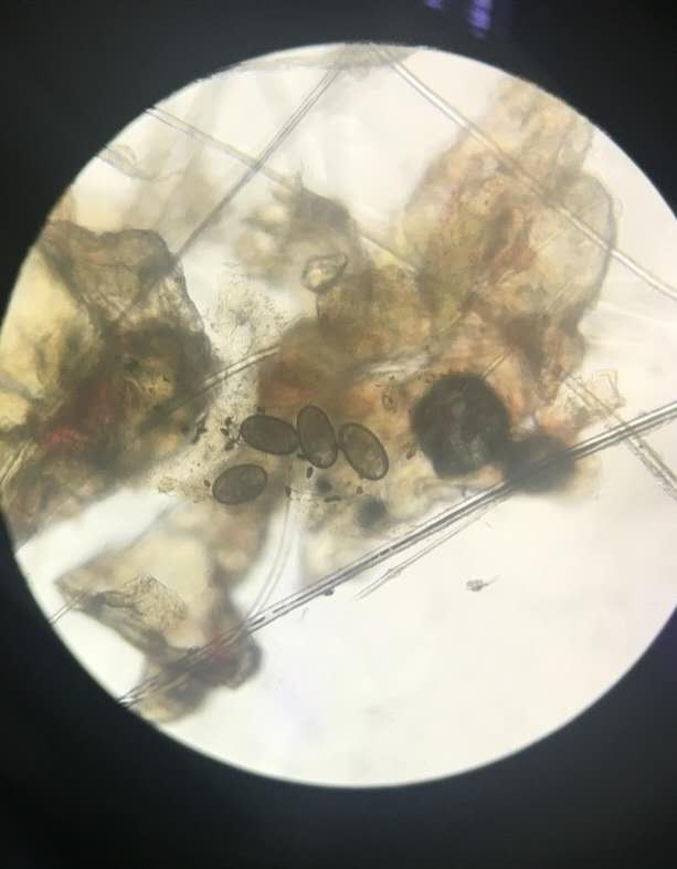 显微镜下的螨虫卵图片图片