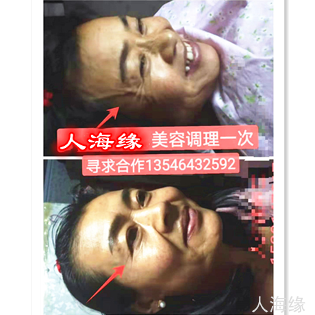 美容
