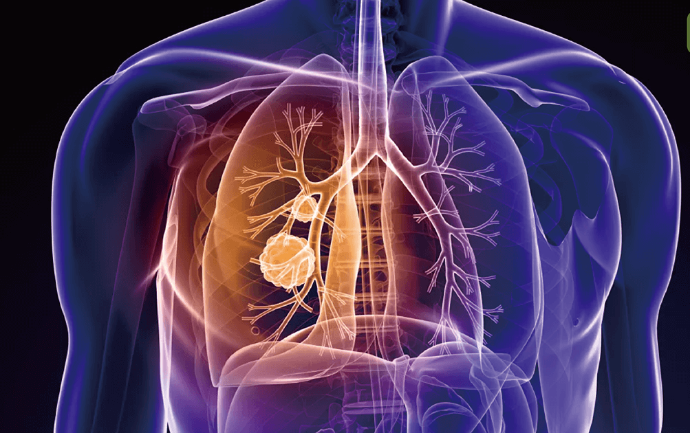 肺纖維化將能逆轉！臺大登國際期刊：不只肺臟，各器官都有救了！