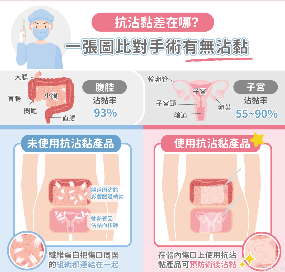 手术后「沾黏」是什么？有无使用「抗沾黏」产品差在哪？