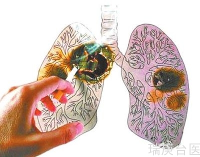 案例 | 肺癌質子治療 生命新希望