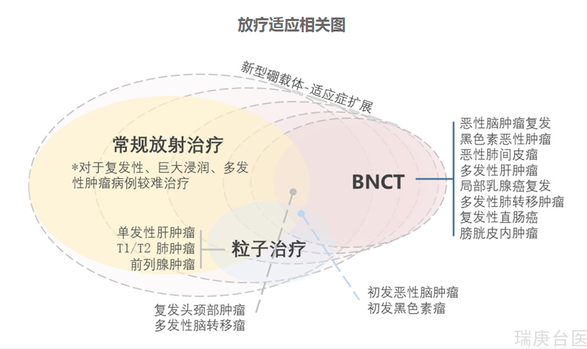 BNCT案例 | 硼中子治療頭頸癌&治療流程