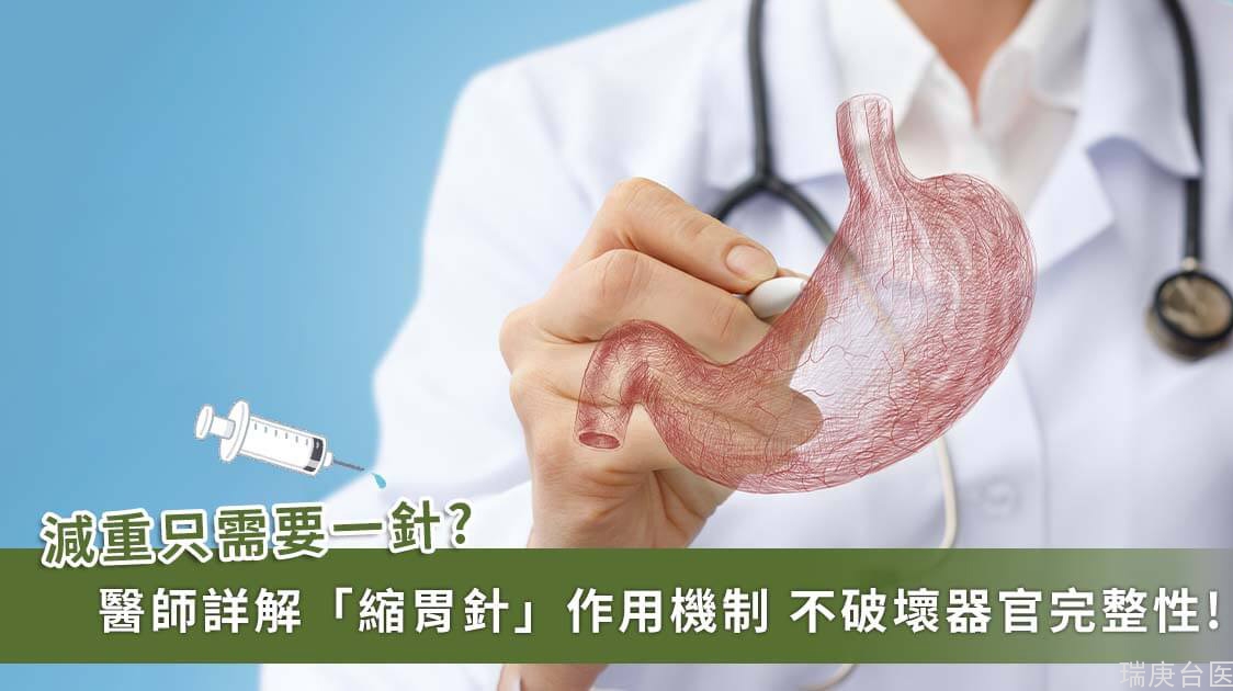 「縮胃針」真的能「縮胃」嗎？臺灣醫師詳解「胃肉毒桿菌注射」的作用機制、恢復期、副作用、費用