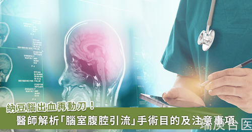 纳豆脑出血再动刀！医师解析什么是「脑室腹腔引流」手术？