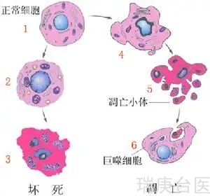 BNCT | 硼中子俘获疗法的优缺点