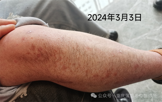 20250319210807_56939.png 640.png